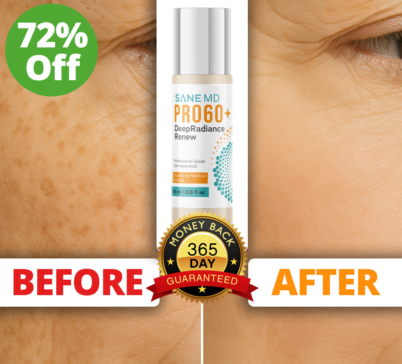 SANE MD VITAAE Three bottles