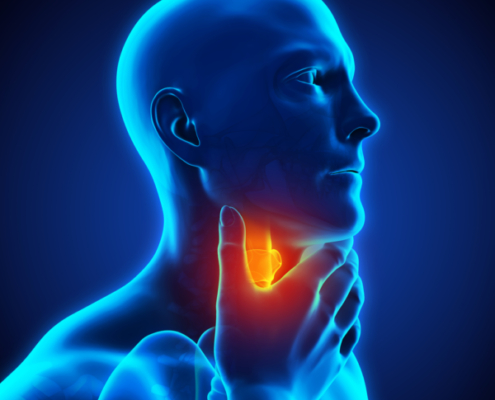 A graphical image of a man with throat cancer.