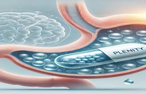 An artists rendering of a human stomach with a plenity capsule inside