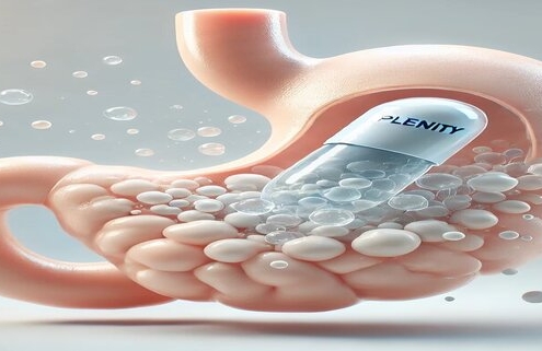 Does Plenity work? Illustration of a stomach with a Plenity capsule dissolving and surrounded by expanding hydrogel particles, visually demonstrating its mechanism of promoting fullness for weight management.