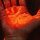 bright red light shining on skin that is an older hand