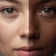 Dark Spots on Face Causes skin darkening hormone light skin becoming darker from left to right on someones face