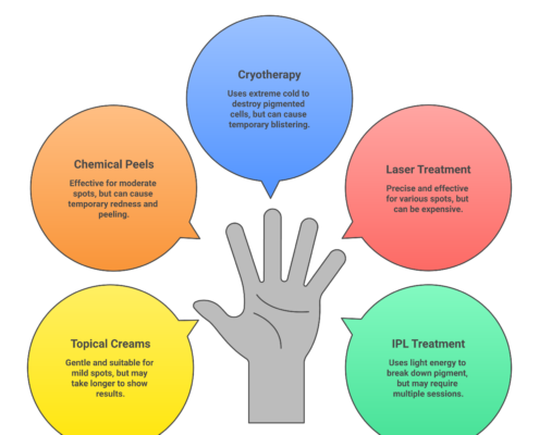 Age Spots on Hands: What Causes Them and How to Get Rid of Them for Good Causes and treatment options for age spots on hands including topical creams and laser therapy