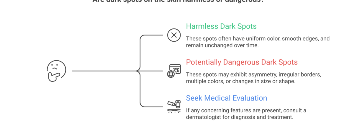 How to tell if dark spots are harmless or dangerous using the ABCDE melanoma checklist