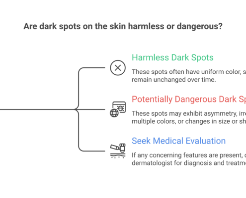 Are Dark Spots Dangerous? How to Tell the Difference and When to Worry How to tell if dark spots are harmless or dangerous using the ABCDE melanoma checklist